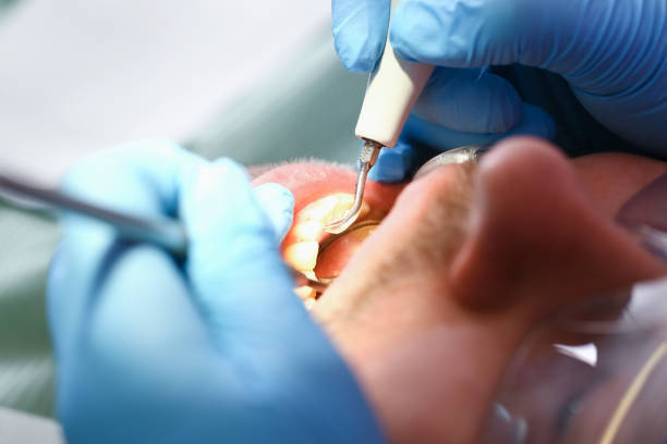 Best Broken or Cracked Tooth Emergency Dentist in Flint, MI