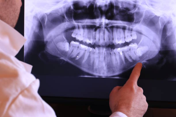 Best Emergency Dentist for Knocked-Out Tooth in Flint, MI